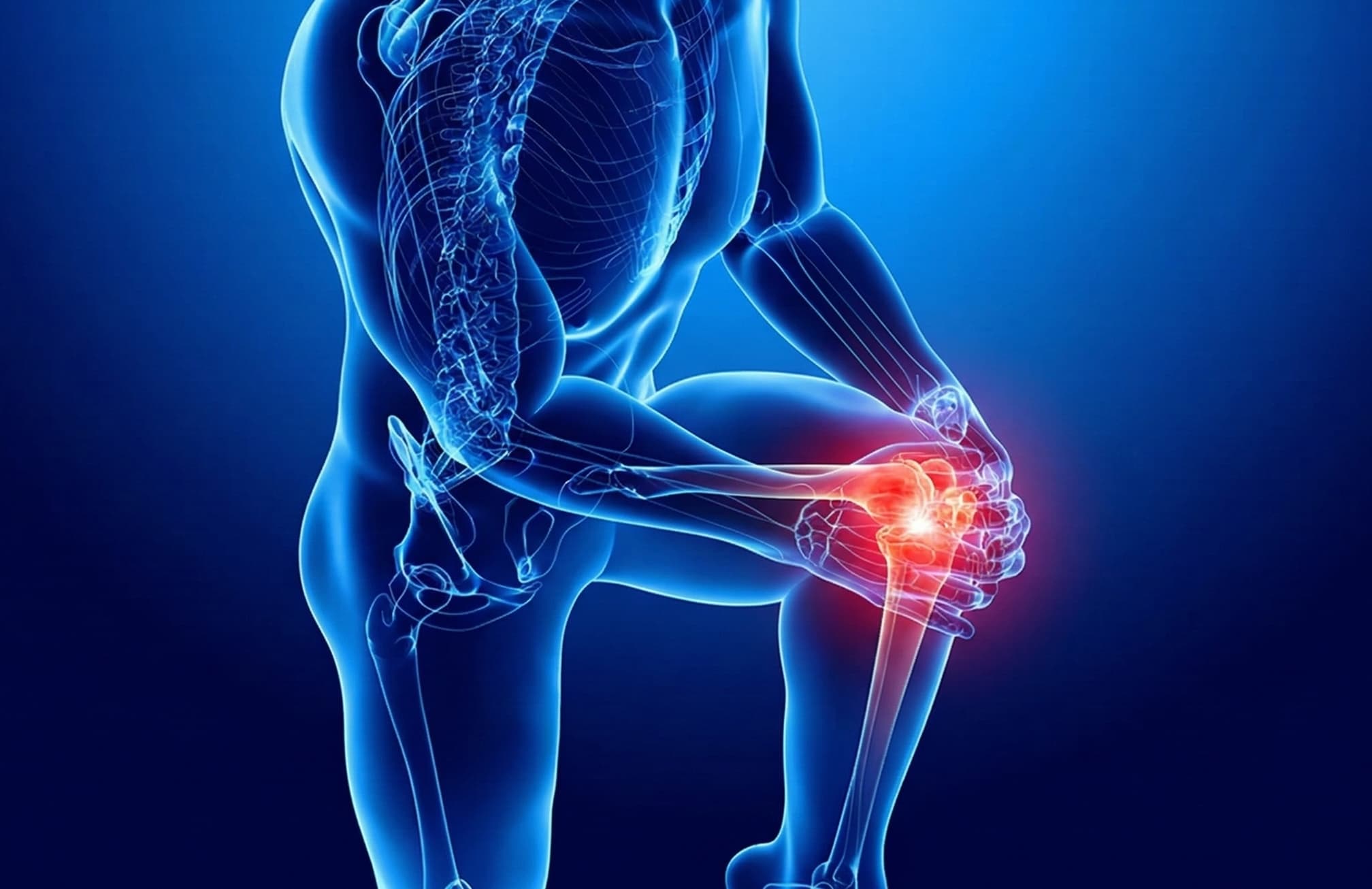 Genicular Artery Embolization